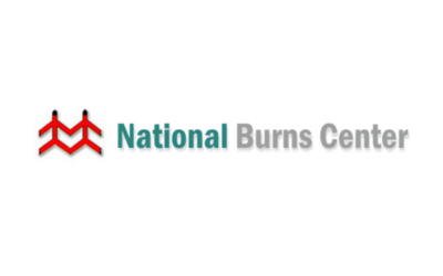 national burns center